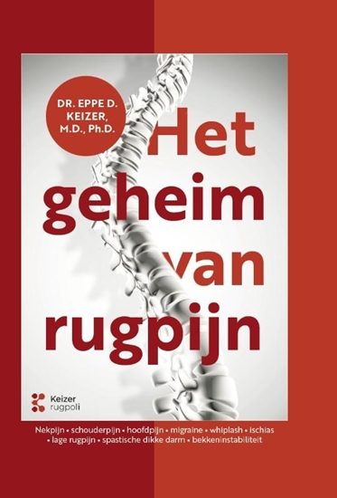 Afbeelding van Het geheim van rugpijn