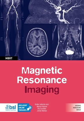 Afbeeldingen van Medische beeldvorming en radiotherapie Magnetic Resonance Imaging