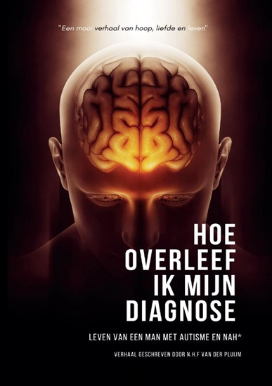 Afbeelding van Hoe overleef ik mijn diagnose