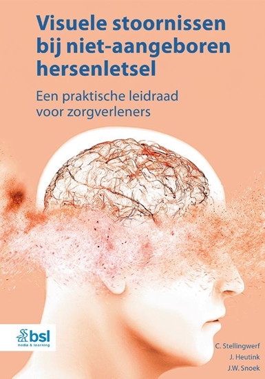 Afbeelding van Visuele stoornissen bij niet-aangeboren hersenletsel