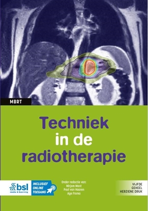 Afbeeldingen van Medische beeldvorming en radiotherapie Techniek in de radiotherapie