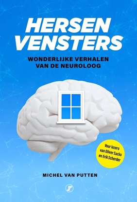 Afbeeldingen van Hersenvensters