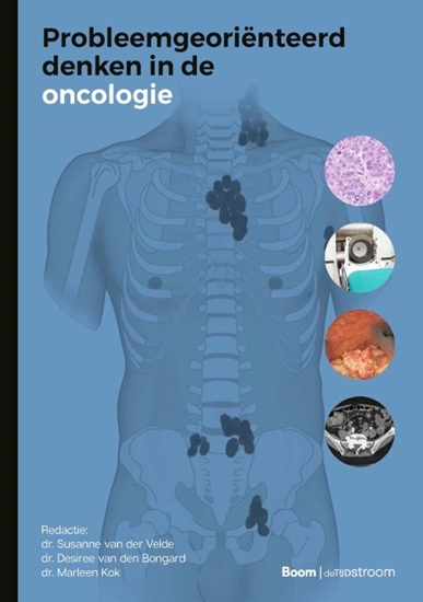 Afbeelding van Probleemgeoriënteerd denken in de oncologie