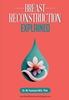 Afbeelding van Breast Reconstruction Explained