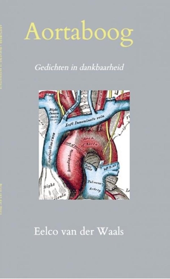 Afbeelding van Aortaboog