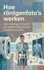 Afbeelding van Hoe röntgenfoto's werken