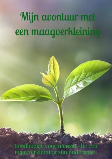 Afbeelding van Mijn avontuur met een maagverkleining