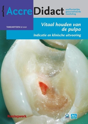 Afbeeldingen van AccreDidact Vitaal houden van de pulpa