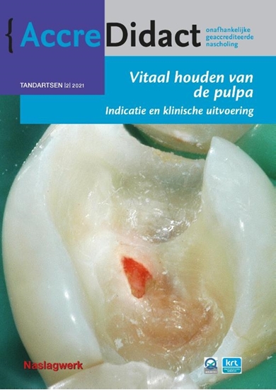 Afbeelding van AccreDidact Vitaal houden van de pulpa