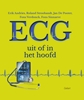 Afbeelding van ECG