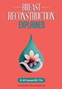 Afbeelding van Breast Reconstruction Explained