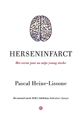 Afbeeldingen van Herseninfarct