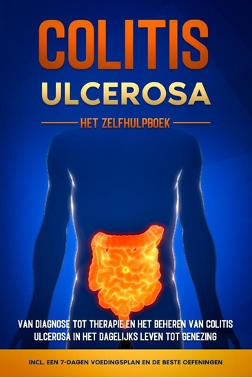 Afbeelding van Colitis Ulcerosa – Het Zelfhulpboek: Van Diagnose tot Therapie en het Beheren van Colitis Ulcerosa in het Dagelijks Leven tot Genezing – Inclusief een 7-Dagen Voedingsplan en de Beste Oefeningen