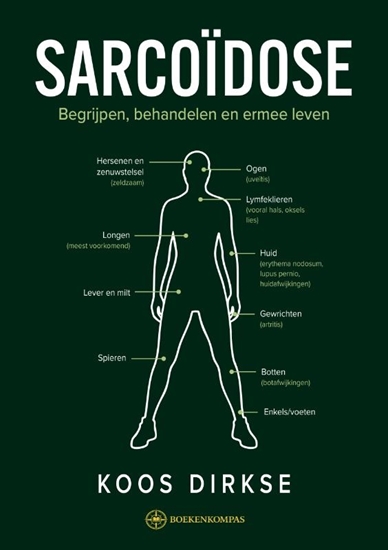 Afbeelding van SARCOÏDOSE