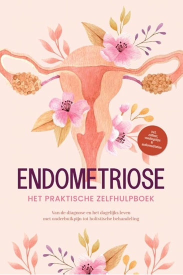 Afbeelding van Endometriose - Het praktische zelfhulpboek: Van de diagnose en het dagelijks leven met onderbuikpijn tot holistische behandeling - incl. zelftest, voedingstips & audiomeditaties
